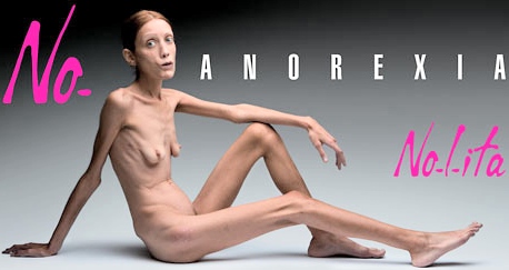 Anorexia.jpg